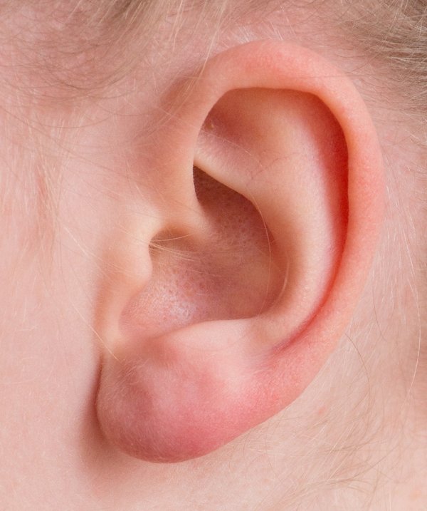 Bouton dans l'oreille : 5 solutions pour soulager votre gêne